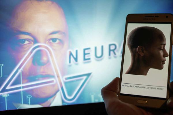 Neuralink của Elon Musk được thử nghiệm trên người