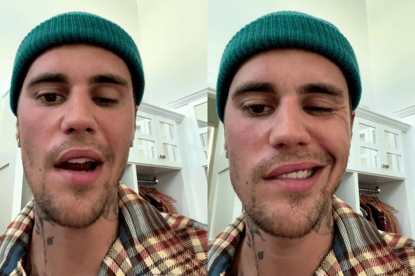 Justin Bieber bất ngờ huỷ hàng loạt show vì liệt cơ mặt