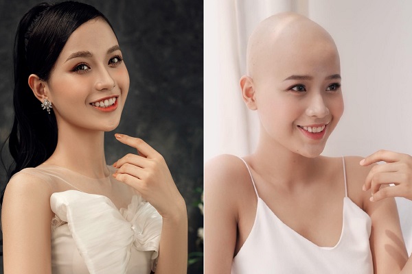 Cô gái chiến thắng ung thư... thi 'Miss World Vietnam'