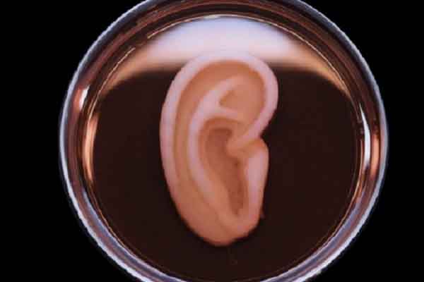 Ghép tai in 3D từ tế bào sống của chính mình thực hiện thành công