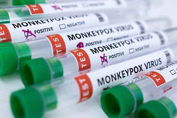Bộ Y tế họp khẩn cấp ứng phó bệnh dịch đậu mùa khỉ