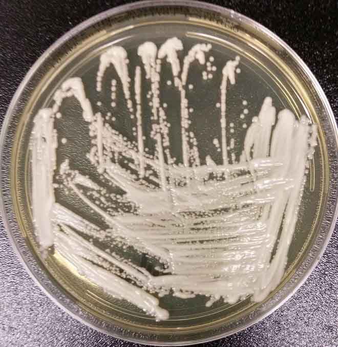 Bệnh nhân COVID-19 có thể bị tử vong vì một loại siêu nấm độc hại
