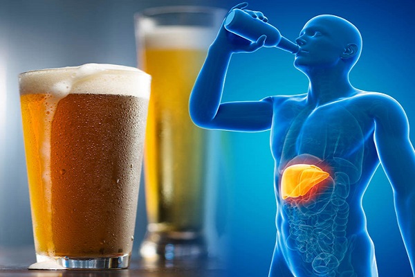 Liệu ung thư gan có phải chỉ do bia rượu?