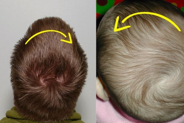 Giải mã 2 xoáy tóc ở trẻ: Liệu có phải dấu hiệu nhận biết thiên tài?