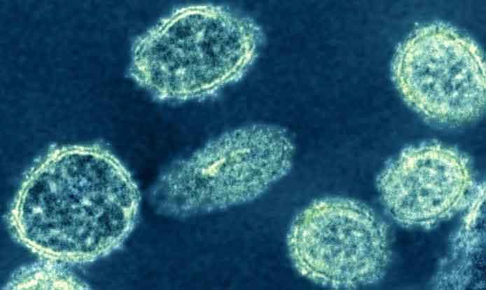 Phát hiện vi-rút cúm lợn mới ở Trung Quốc có khả năng gây đại dịch