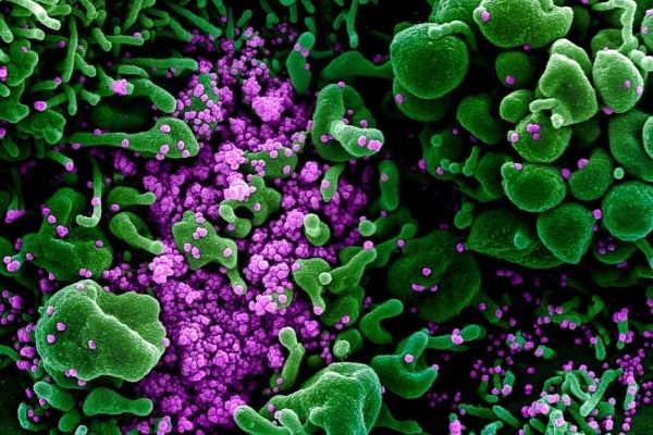Sốc với hình ảnh virus nCoV ‘giết chết’ tế bào người