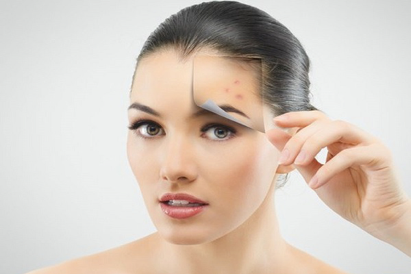 Giải pháp cho mụn trứng cá vùng trán