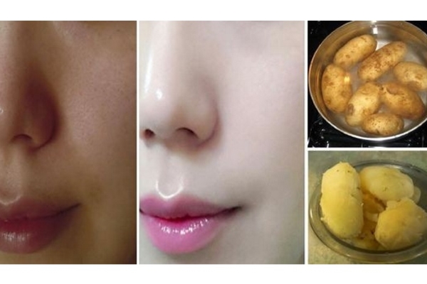 Mặt nạ khoai tây làm da trắng hồng tức thì