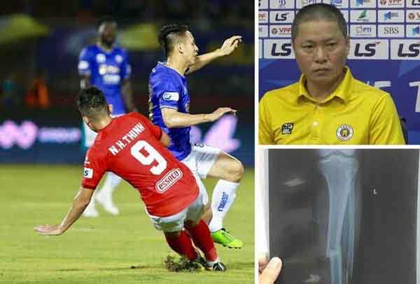 Đau đớn nhìn Hùng Dũng gãy chân, HLV Hà Nội tha thiết: ‘Xin đừng triệt hạ đồng nghiệp’