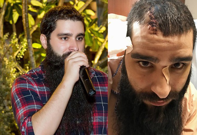 2 Việt kiều trong vụ đánh đạo diễn Kong đã trốn khỏi Việt Nam