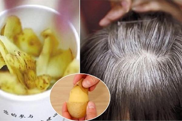 Vỏ khoai tây giúp bạn quên đi nỗi lo tóc bạc