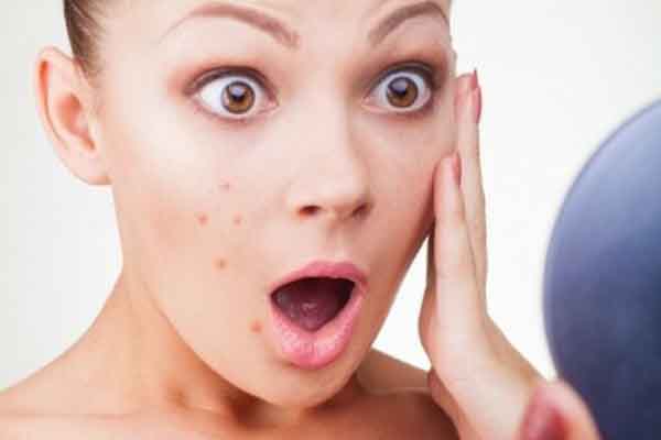 Những dấu hiệu làn da cảnh báo bạn cần phải thay kem dưỡng ẩm ngay