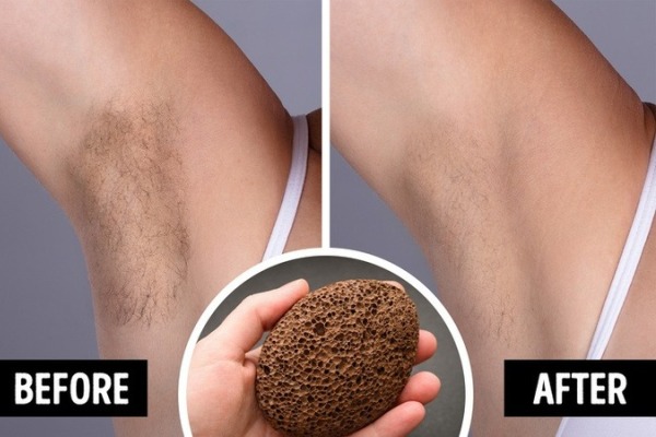 Hô biến làn da sạch “vi ô lông” và vết thâm trong những ngày ở nhà “tránh dịch”