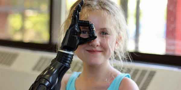 “Nữ chiến binh” cụt tay và hành trình lan truyền nghị lực