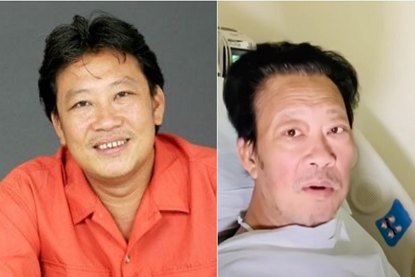 Nhạc sĩ Lê Quang phẫu thuật cắt bàn chân phải vì bệnh tiểu đường