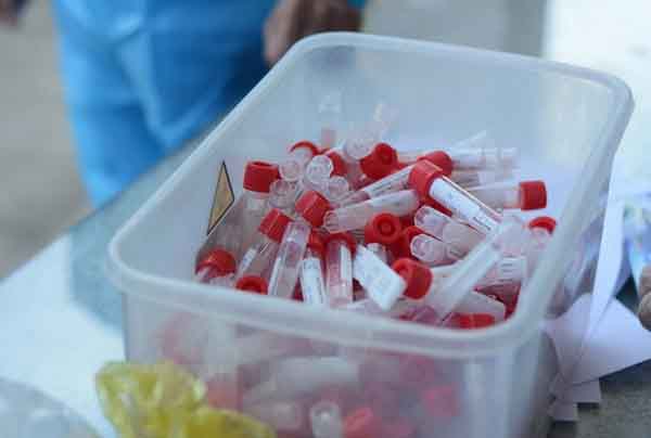 Bệnh nhân COVID-19 thứ 43 tử vong có tiền sử xơ gan