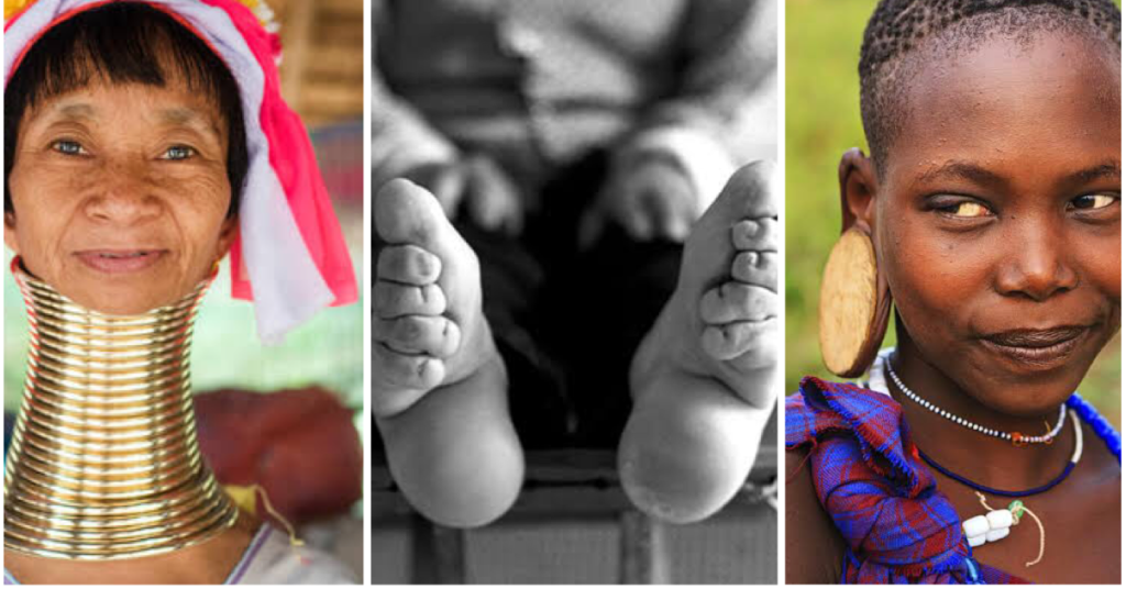 Ngỡ ngàng trước những tiêu chuẩn vẻ đẹp không tưởng trên Thế giới