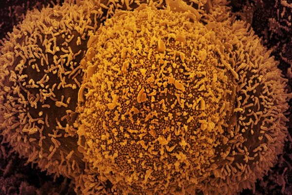 Châu Âu tiếp tục nới lỏng phòng dịch, WHO cảnh báo sự nguy hiểm của biến thể Delta