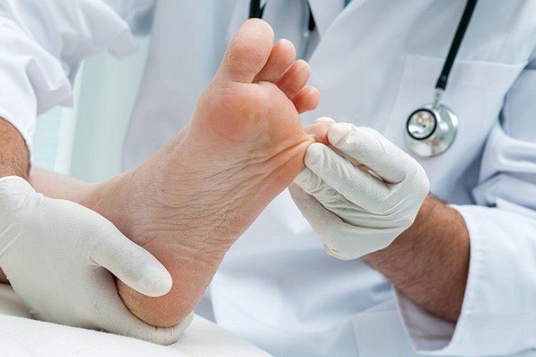 Cách trị nấm da chân hiệu quả tại nhà
