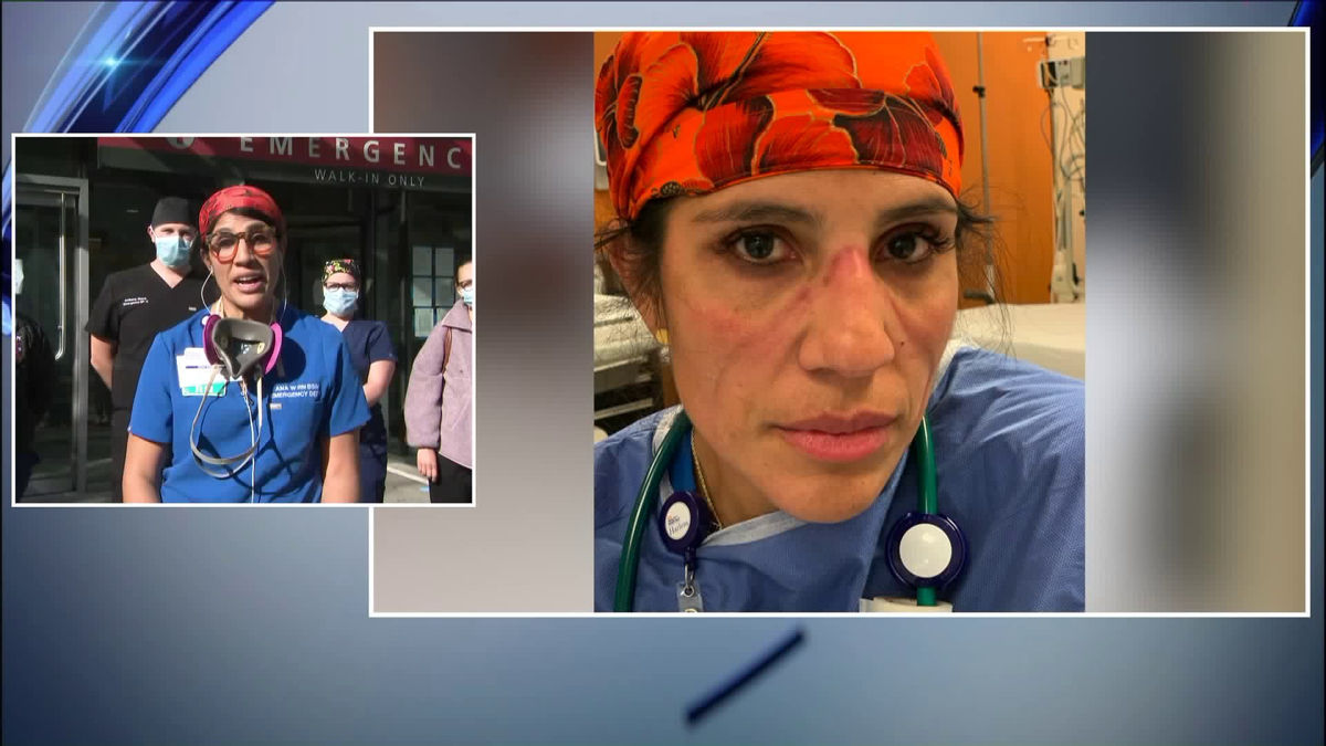 Nữ y tá mắc COVID-19 sau khi tiêm vắc xin, khó thở và đau đầu, chuyên gia nói gì?