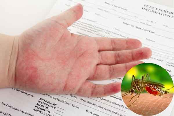 Những sai lầm khiến bệnh sốt xuất huyết ngày càng trở nặng