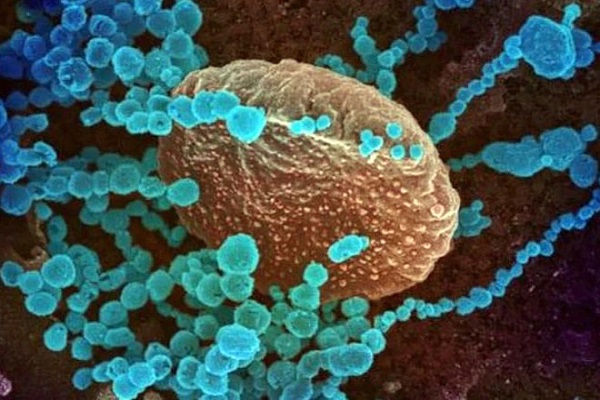 Sự nguy hiểm của biến thể vi rút COVID-19 Delta