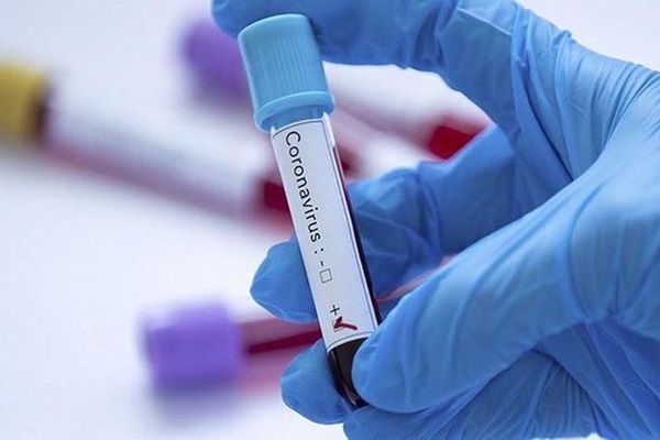 Hãy nói không với dịch vụ xét nghiệm COVID-19 theo yêu cầu