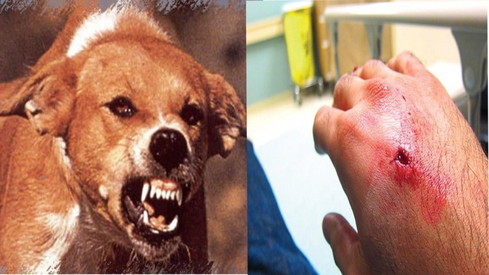 Hai bé trai tử vong sau khi bị chó dại cắn