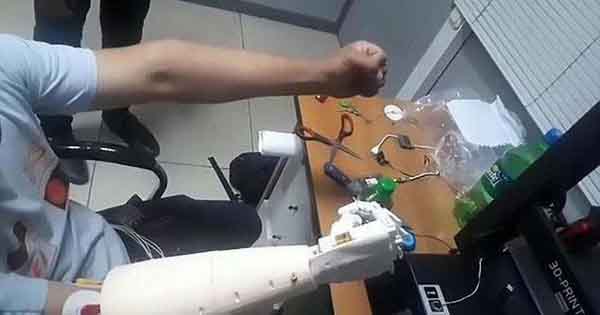 Xem video người đàn ông dùng ý nghĩ điều khiển tay giả