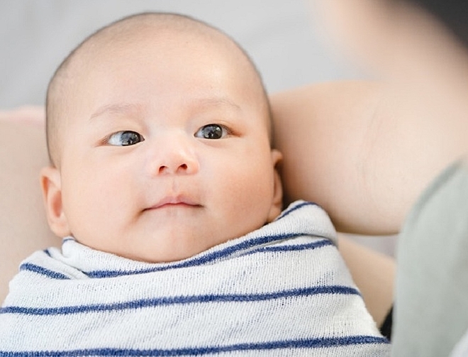 Mắt một mí có phải là do di truyền?