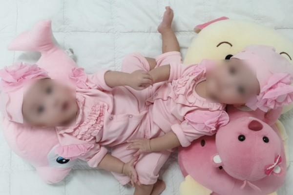 100 y bác sĩ thực hiện ca mổ tách cặp dính liền phức tạp nhất Việt Nam