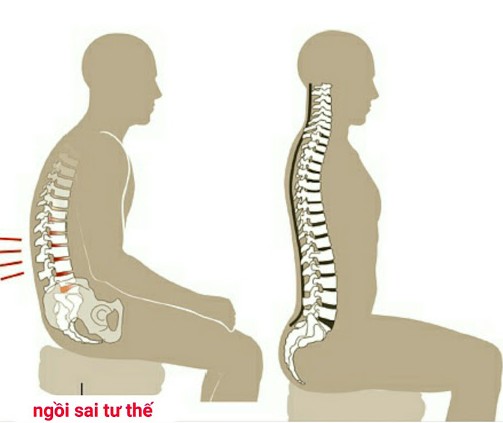 Chỉ cần giữ tư thế thẳng người, bạn sẽ khỏe mạnh hơn