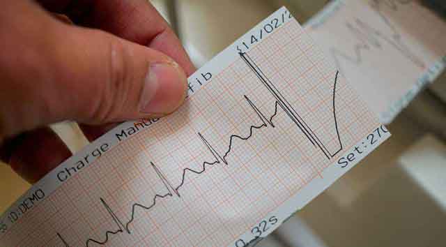 Nhịp tim như thế nào thì nguy hiểm?