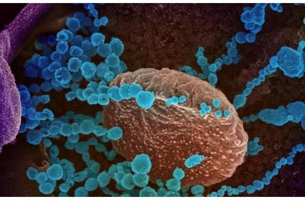 SARS-CoV-2 vẫn ‘sống khỏe’ ở nhiệt độ cao