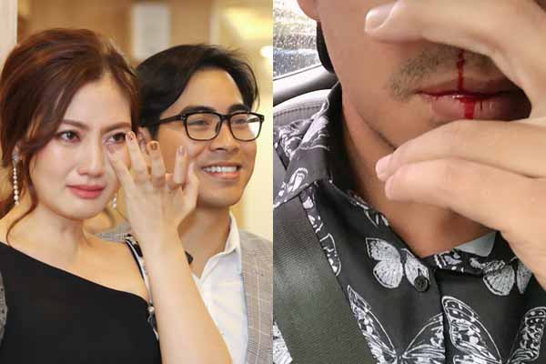 Chồng Ngọc Lan đột ngột chảy máu mũi, Lương Thế Thành – Hùng Thuận lo ngại