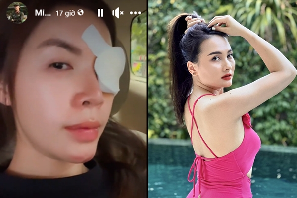 Sao Việt 28/6: Minh Tú gây lo lắng về tình trạng sức khỏe không ổn định, Bảo Thanh khoe sắc vóc ‘mẹ bỉm sửa’ 