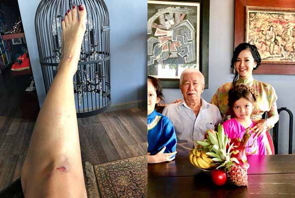 Ca sĩ Hồng Nhung bị tai nạn đầu năm mới