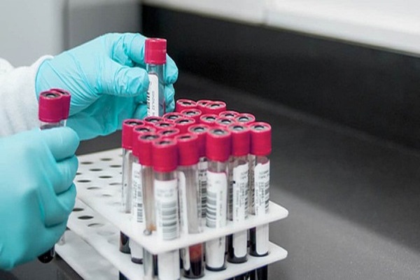 Máu nhân tạo nuôi trong phòng thí nghiệm lần đầu tiên được truyền vào cơ thể người