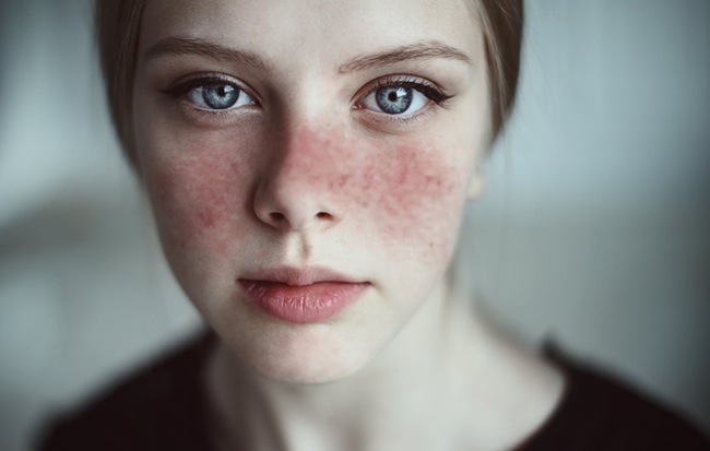 Ba căn bệnh nguy hiểm, dễ xuất hiện phái nữ nên lưu tâm