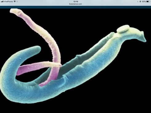 Trong cơ thể con người, có ‘quái vật’ hay không?