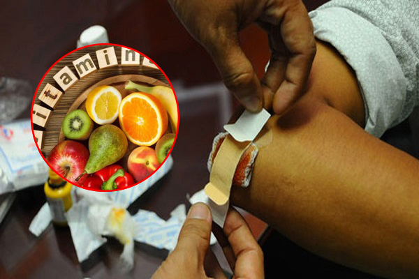 Top 5 loại thực phẩm hỗ trợ lành vết thương hiệu quả